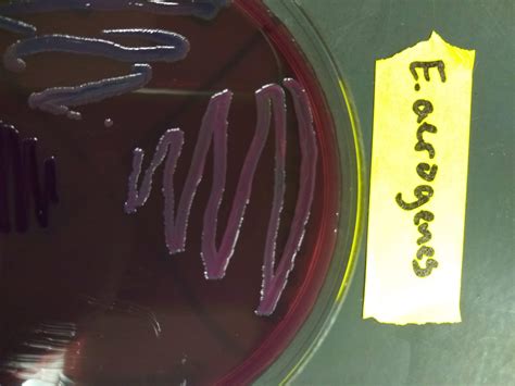 enterobacter aerogenes on emb|EMB Agar.